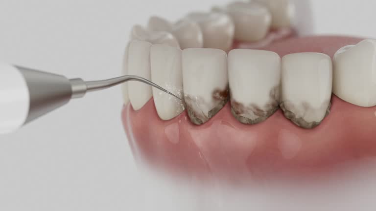 Reliable Invisalign Clear Aligners contractor in Alamo, CA by Smile Center Dentistry